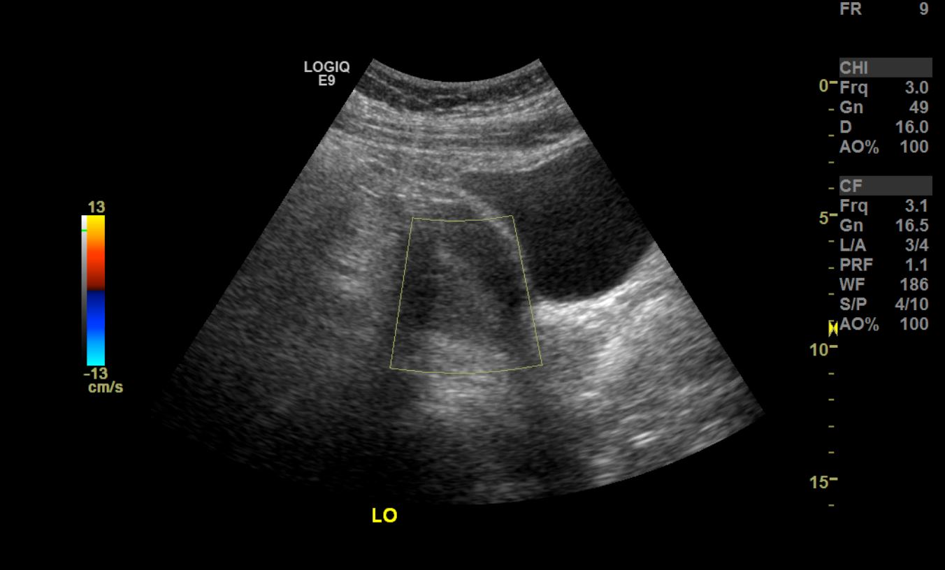 Obesity Related Comorbid Conditions Laparoscopic.MD